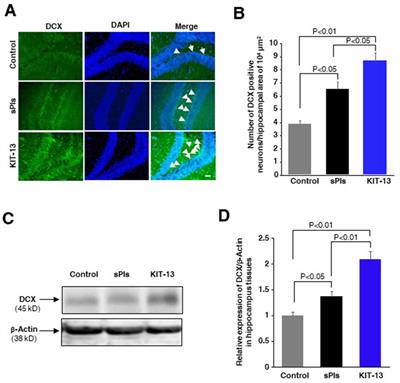 KIT-13, a novel plasmalogen derivative, attenuates neuroinflammation and amplifies cognition